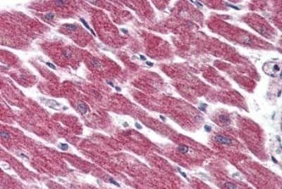 Immunohistochemistry-Paraffin: GPR116 Antibody [NBP3-14341] - Immunohistochemistry of formalin-fixed, paraffin-embedded human heart after heat-induced antigen retrieval.